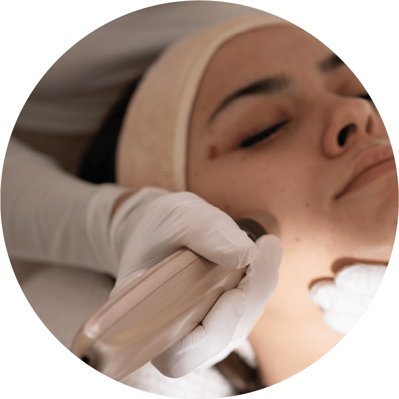 Needling Behandlung in Freudenstadt